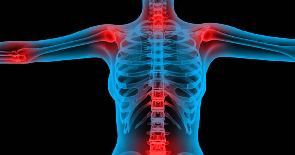 Osteoporosis 101: How Osteoporosis Works
